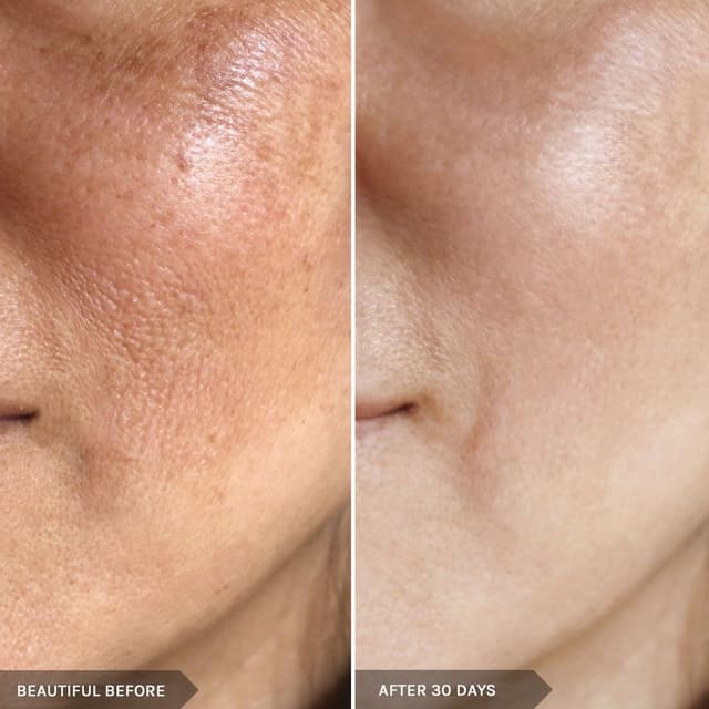LUMECCA PEAK FACIAL at Remake Beauty Studio Mission in Mission, TX